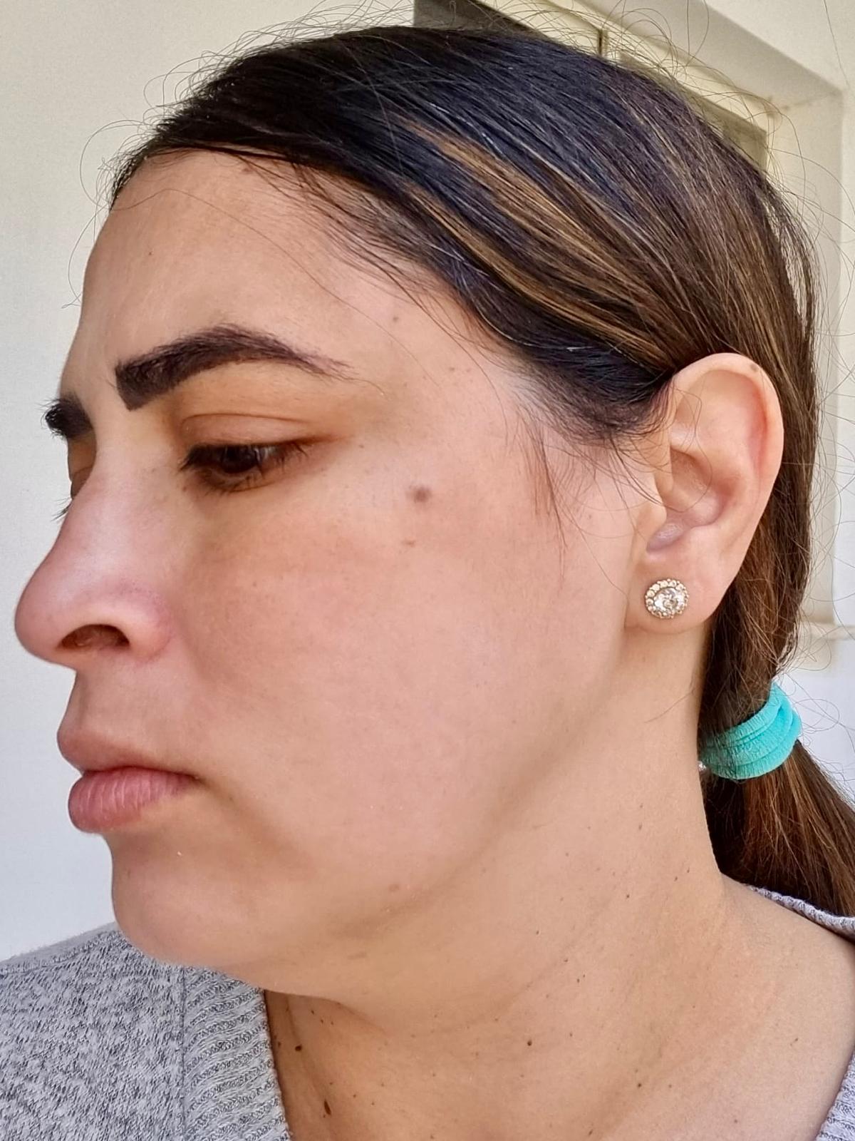 דגנית כתמים (1)
